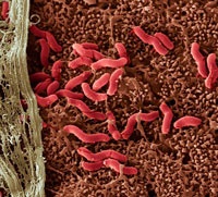 Helicobacter pylori (Helicobacter pylori)