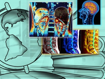 Miért kontraszt használt MRI (szkenner) Miért használja kontraszt MRI