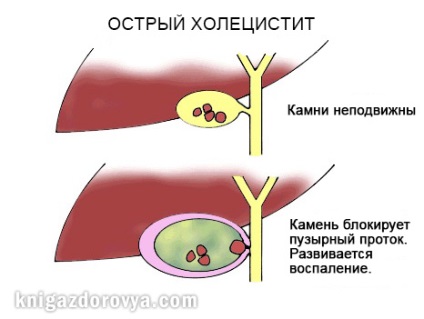 Székrekedés - a tüneteket, megelőzése és kezelése székrekedés népi jogorvoslat, egészségügyi könyv