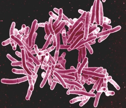 Zooantroponoznye betegségek rövid kitérő bakteriológiai
