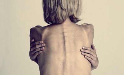 Anorexia, hogyan lehet megelőzni a fejlesztési veszélyes betegség