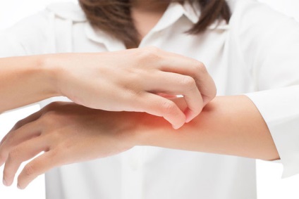 Az atópiás dermatitis - tények és mítoszok (atópiás) Az atópiás dermatitis - tények és mítoszok