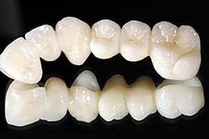 A cirkónium a fogászatban, hogy jobban cirkónium fémkerámia vagy fogak (oxid)