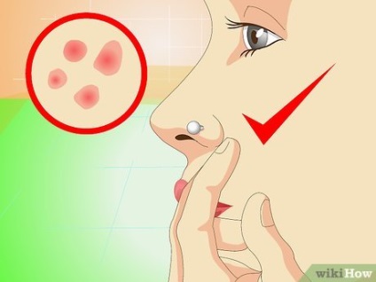 Hogyan kell kezelni a fertőzés az orr piercing