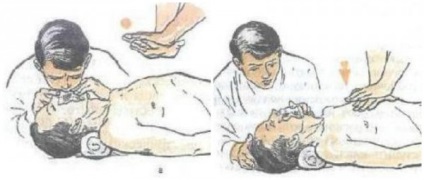 Hogyan segíthet a fuldokló CPR és az elsősegély