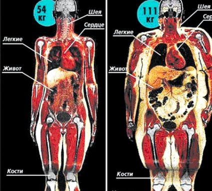 hogyan lehet eltávolítani a zsírt az emberi testben fogyás jön a mikrogynon 30 ból
