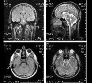 MRI az agy - a cím és az ár