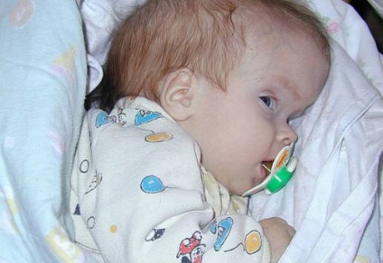 Fejkörfogat mérete egy újszülött gyermek norma havi fejek