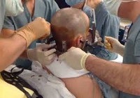 Műtét a koponyán - az árak Moszkvában található 100 árak