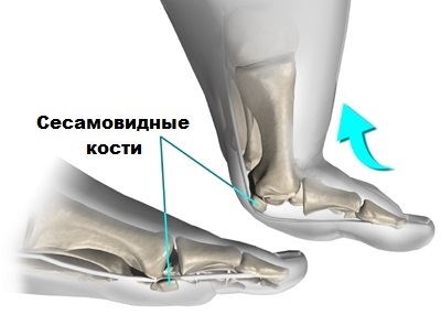 Kereszt lúdtalp tünetei és kezelése Moszkva, műtéti kezelése deformitás Moszkvában