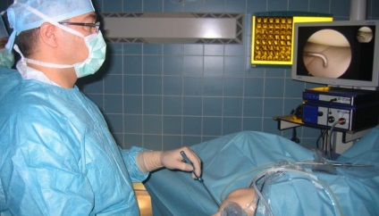 Eltávolítását a meniszkusz és helyreállítási a műtét után a térd meniscus