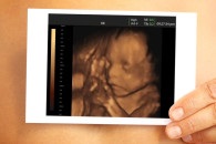 magzati szívverés ultrahang, amikor hallja a baba szíve, minden héten