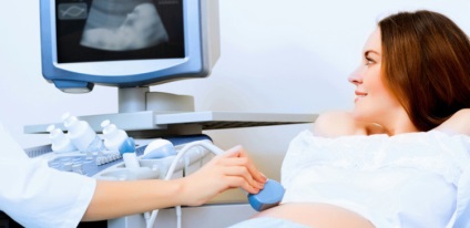 magzati szívverés ultrahang, amikor hallja a baba szíve, minden héten
