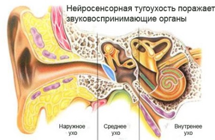 A halláskárosodás - az okok, tünetek, tünetei és kezelése