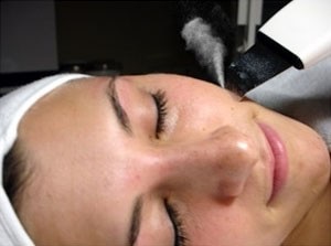 Ultrahangos peeling - ez az ár, vélemények, képek és videó az ultrahangos peeling arc