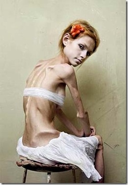 Anorexia, mint egy életmód (anorexia) Anorexia mint életmód