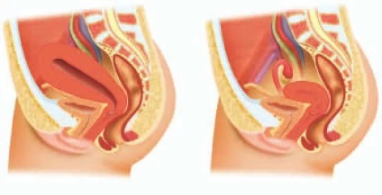 Ergometrin használati utasítást, ár, vélemények és analógok