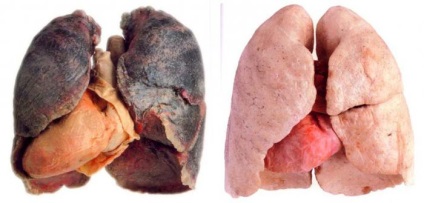 Dohányzó és nem dohányzó dohányzás hatásairól az emberi szervezetre