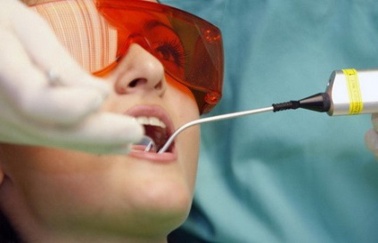 fogat ciszta kezelés