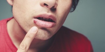 Miért fáj a sarka az ajkak okok, kezelés