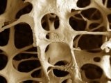 Miért orvosok azt javasolják, mezítláb, a hálózat ortopédiai szalonok Dr. darazsak
