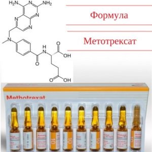 Rheumatoid arthritis a térdízület tüneteket és a kezelés (közös) Rheumatoid arthritis a térd tünetek és a kezelés