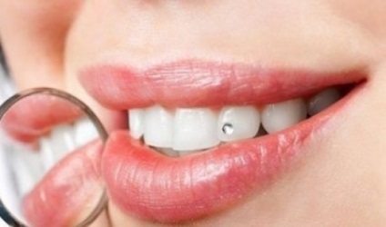 Skys zuba- vagy piercing típusok, rögzítési módszerek, telepítési utasításokat
