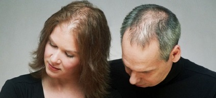 Telogen alopecia, hogy az ok és a kezelés a betegség