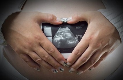 10 hetes terhesség placenta chorion membránok, 10 hetes terhes