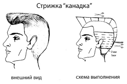 5 ok, hogy válasszon egy frizura, ami hangsúlyozzák kanadai egy férfi egy férfi - haircutmen