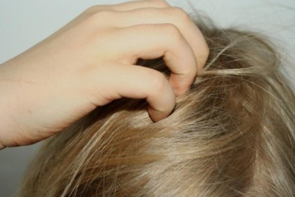 Allergia és a hajhullás, a haj problémák