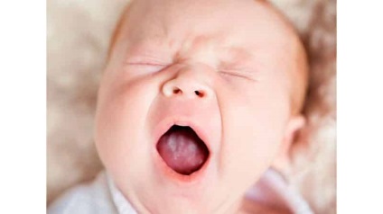 Fehér nyelv bevonat csecsemők hogyan kell tisztítani, és távolítsa