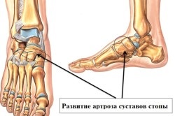 Ízületi fájdalom a láb okok és a kezelés