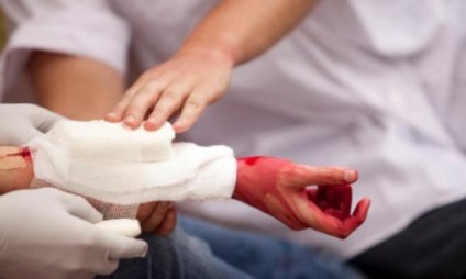 Mi a vérzéscsillapító terápia és hogyan használják