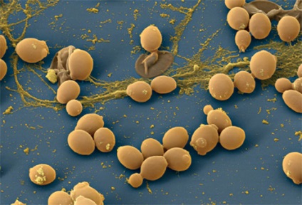 élesztő gombák a körmök diagnosztikáján kezelje a körömgombát szuper tisztítóval