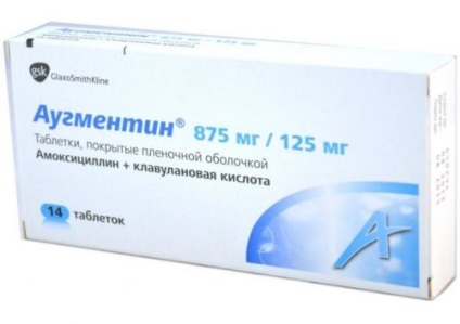 Hatékony gyógymód hurutok, inhaláció (nagyon részletesen leírja) Egy hatékony gyógymód hurutok, inhalációs