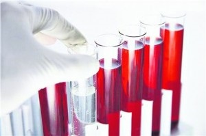 Hematológia - onkológiai betegségek, a vér, JMD vita