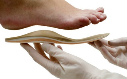 Hogyan válasszuk ki a footbeds származó lúdtalp (kiválasztás) Hogyan válasszuk ki a footbeds származó lúdtalp