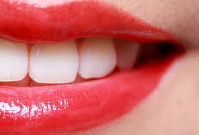Hogyan készítsünk fehér fogak otthon, női-Fi