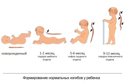 Kyphosis, lordosis és gerincferdülés a gerinc