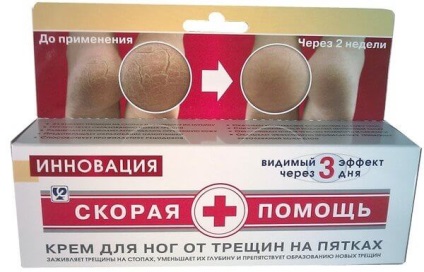 repedések sarkú diabétesz kezelésére)