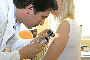 Melanoma a bőr tünetek, okok, megelőzés és a kezelés