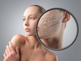 Anti-aging maszk száraz bőrre