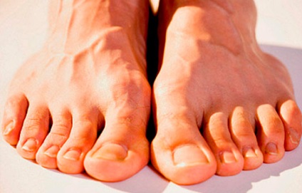 Bőrirritációk a lábujjak között