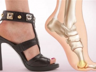 Ortopéd cipő, hogyan kell kiválasztani, hogy mit méltóság