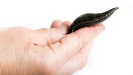 Piócák otthon, mint egy boltban, és tartsa őket a hosszú távú terápiás alkalmazása (pióca) Piócák otthon, mint egy boltban, és tartsa őket a hosszú távú terápiás alkalmazása