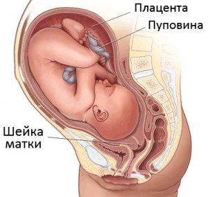 Nyaki idő előtti megnyitása a terhesség, a méh a terhesség alatt