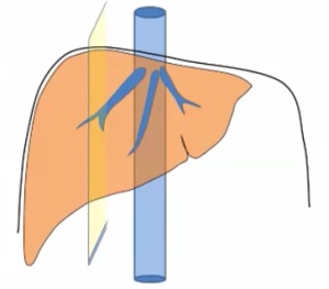 Méretek a máj és az epehólyag ultrahang (Lecture on diagnostere) (méretek) Méretek a máj és az epehólyag ultrahang (Lecture on diagnostere)