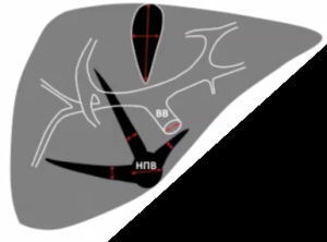 Méretek a máj és az epehólyag ultrahang (Előadás diagnostere) (gall) Méretek a máj és az epehólyag ultrahang (Lecture on diagnostere)