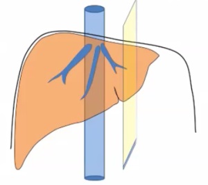 Méretek a máj és az epehólyag ultrahang (Lecture on diagnostere) (buborék) Méretek a máj és az epehólyag ultrahang (Lecture on diagnostere)
